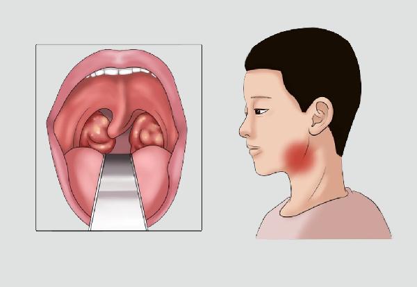 总感觉特别疲乏？主要与这5大要素有关，快对照一下！